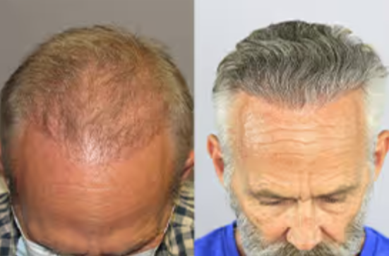 CelluHair Spray Benefits