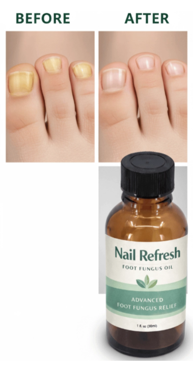 Nail Refresh Before vs After